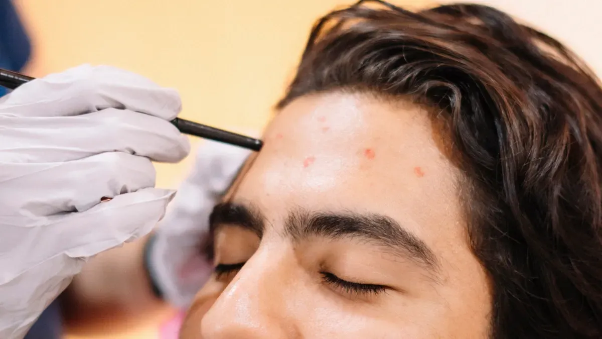 ما هو الغرض الأساسي من استخدام قلم زراعة الشعر؟
